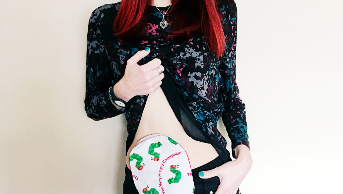 A photo of me lifting my top to show the stoma bag with a Hungry Caterpillar cover over it.
